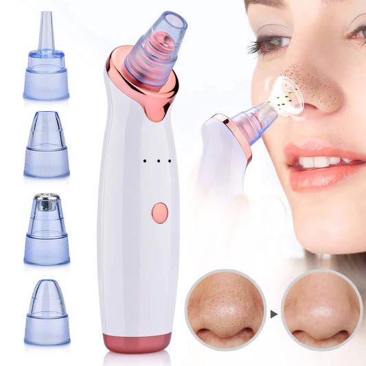 Rechargeable Blackhead Remover